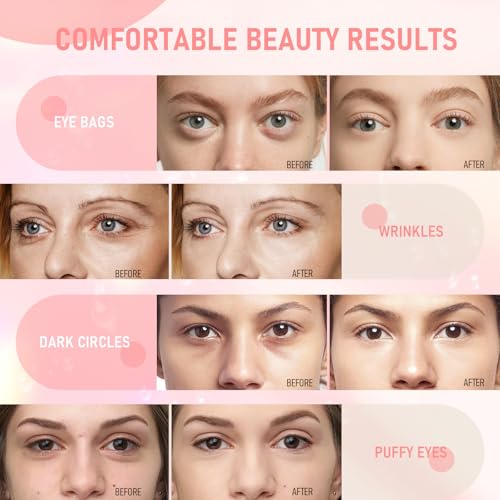 Eye Mask, 30-Pair Collagen Rose Eye Patches for Puffy Eyes and Dark Circles - color: Pink