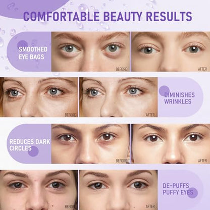 30 Pairs Eye Mask with Retinol, Collagen Eye Patch for Dark Circles and Puffiness, Reduce Wrinkles, Eye Bags and Fine Lines, for Women and Man - color: Deep Purple